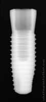 Radiograph of Endure Fixture CP