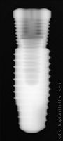 Radiograph of Endure Fixture CP ((Old threads))