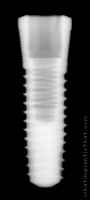 Radiograph of Endure Fixture CP