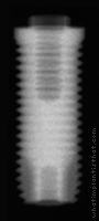 Radiograph of Entegra Screw