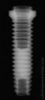 Radiograph of Entegra Screw