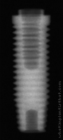 Radiograph of Entegra Screw