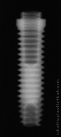 Radiograph of Entegra Screw