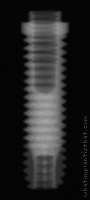 Radiograph of Entegra Screw