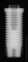 Radiograph of Entegra Screw