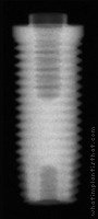 Radiograph of Entegra Screw
