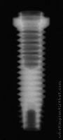 Radiograph of Entegra Screw
