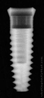 Radiograph of Esthetic Region Implant (ERI)