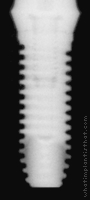 Radiograph of External RBT D3 Threadform