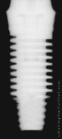 Radiograph of External RBT D3 Threadform