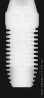 Radiograph of External RBT D3 Threadform