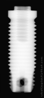 Radiograph of Fixture