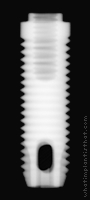 Radiograph of Fixture