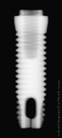 Radiograph of Fixture
