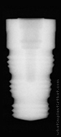 Radiograph of Friadent Frialit-2