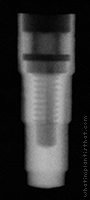 Radiograph of Friadent Frialit-2 Stepped Cylinder