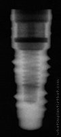 Radiograph of Friadent Frialit Synchro