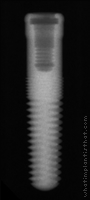 Radiograph of GoDirect
