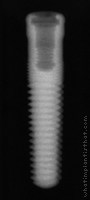 Radiograph of GoDirect