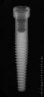 Radiograph of GoDirect
