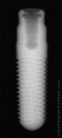 Radiograph of GoDirect