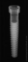 Radiograph of GoDirect