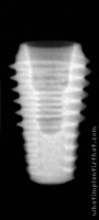 Radiograph of HG III Ultra-Wide