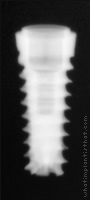 Radiograph of Hati