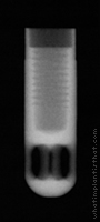 Radiograph of IMZ non-hex