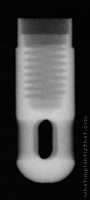 Radiograph of IMZ non-hex
