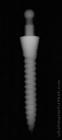 Radiograph of I-Micro