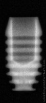 Radiograph of I-system | I-SF 3006 (2)
