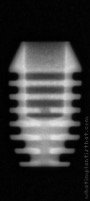 Radiograph of I-system | I-SF 3506 (2)