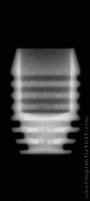 Radiograph of I-system | I-SF 4006 (3)