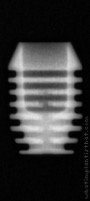 Radiograph of I-system | I-SF 4006 (2.5)