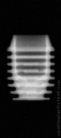 Radiograph of I-system | I-SF 4506 (3)