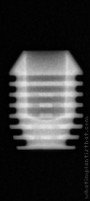 Radiograph of I-system | I-SF 4506 (2.5)