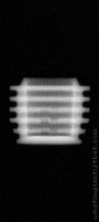 Radiograph of I-system | I-SF 5004 (3)