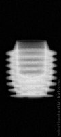 Radiograph of I-system | I-SF 5506 (3)