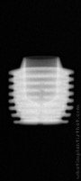 Radiograph of I-system | I-SF 6006 (3)