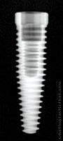 Radiograph of Tri-Nex (Tapered)