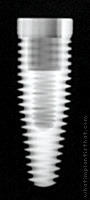Radiograph of Tri-Nex (Tapered)