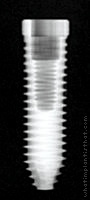 Radiograph of Tri-Nex (Cylindrical)