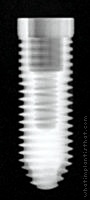 Radiograph of Tri-Nex (Cylindrical)