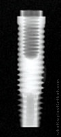 Radiograph of External Hex (Cylindrical)