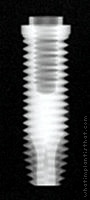 Radiograph of External Hex (Cylindrical)