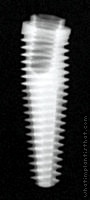 Radiograph of External Hex Co-Axis (Tapered)