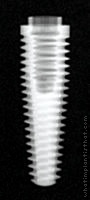 Radiograph of External Hex (Tapered)