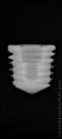 Radiograph of Impl Titamax WS Cortical