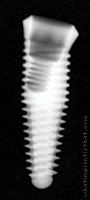 Radiograph of Internal Taper Co-Axis (Tapered)